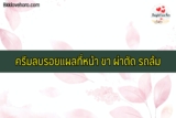 10 ครีมลบรอยแผลที่หน้า ขา ผ่าตัด รถล้ม รักษาได้หมด 2024